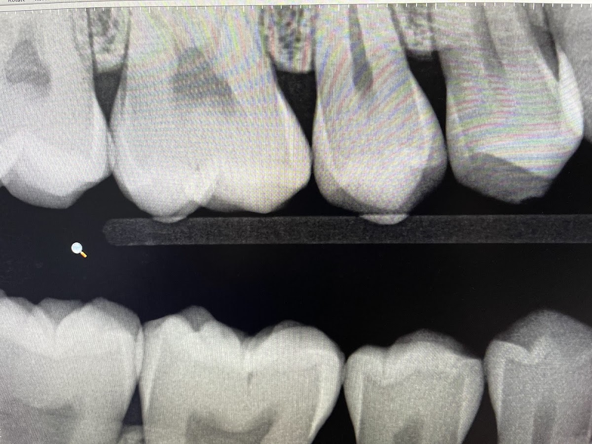 Dr. Sonia Sharma dental clinic in Brampton - Photo 8