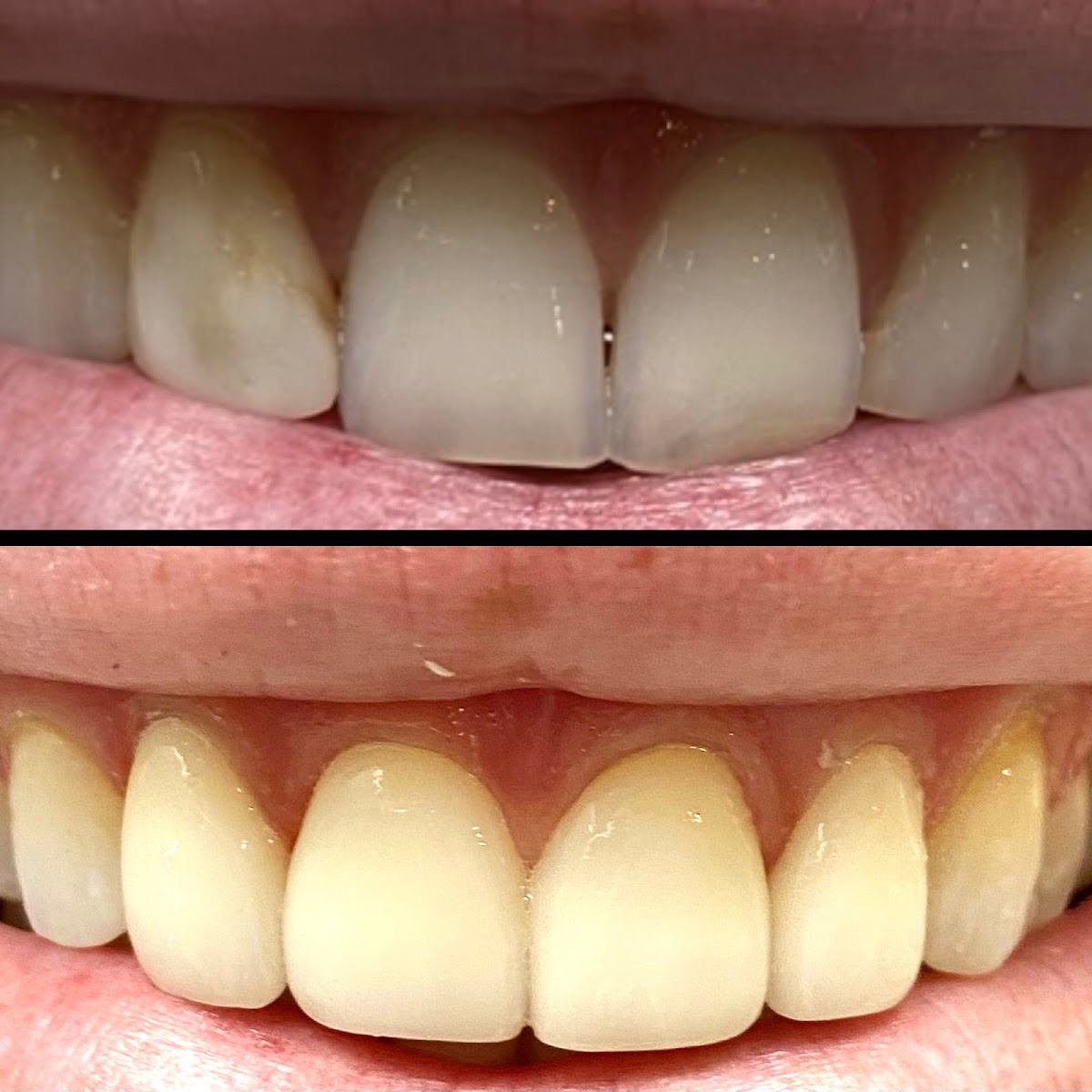 East River Dental Care dental clinic in Newmarket - Photo 4