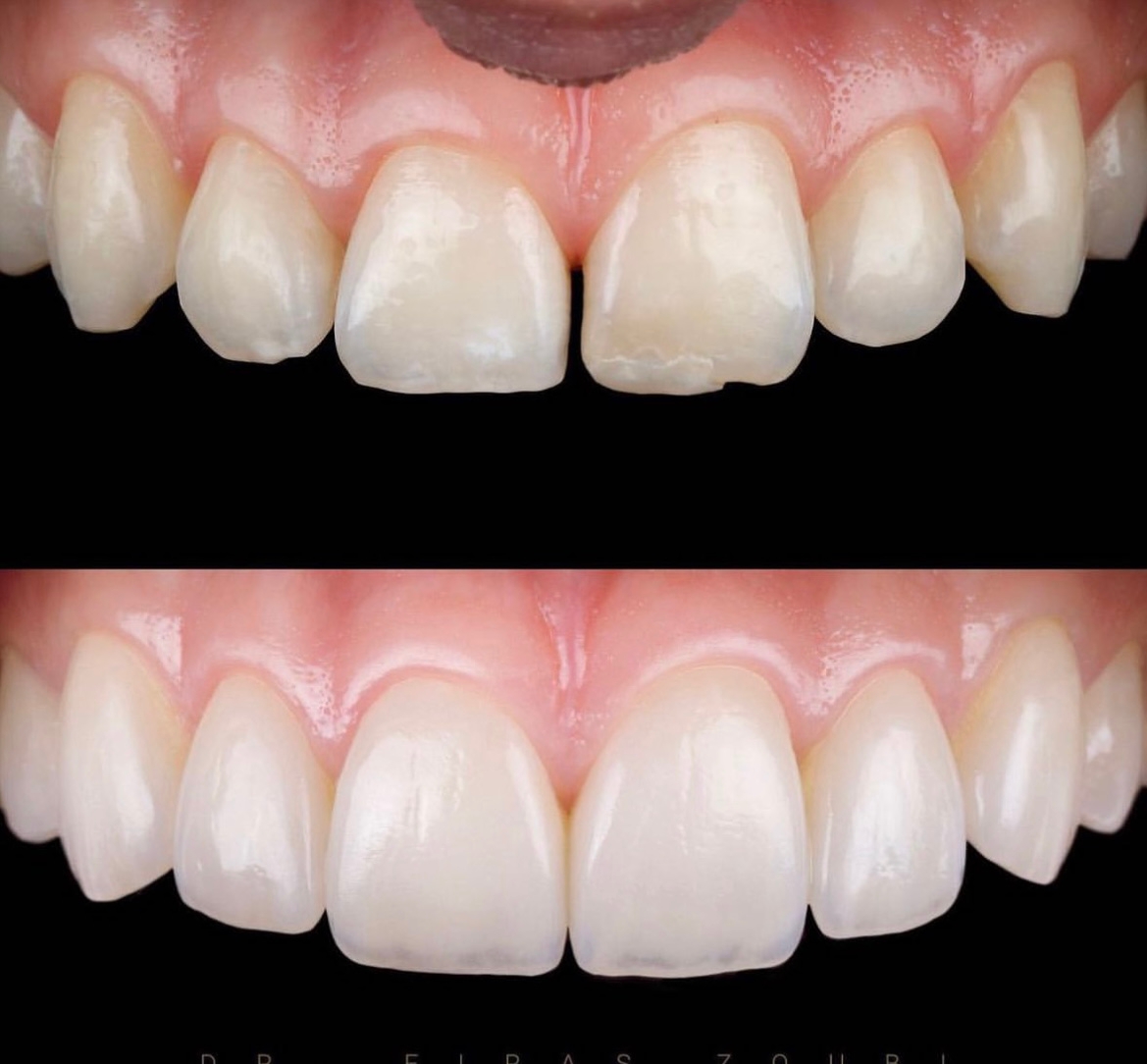 Smile Point Dental - Dental Office Oakville dental clinic in Oakville - Photo 4