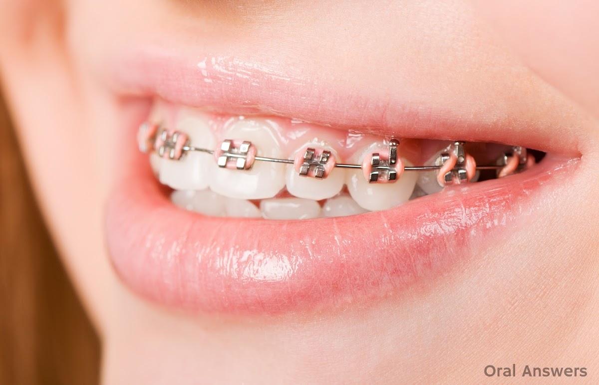 Laird Orthodontics dental clinic in East York - Photo 10