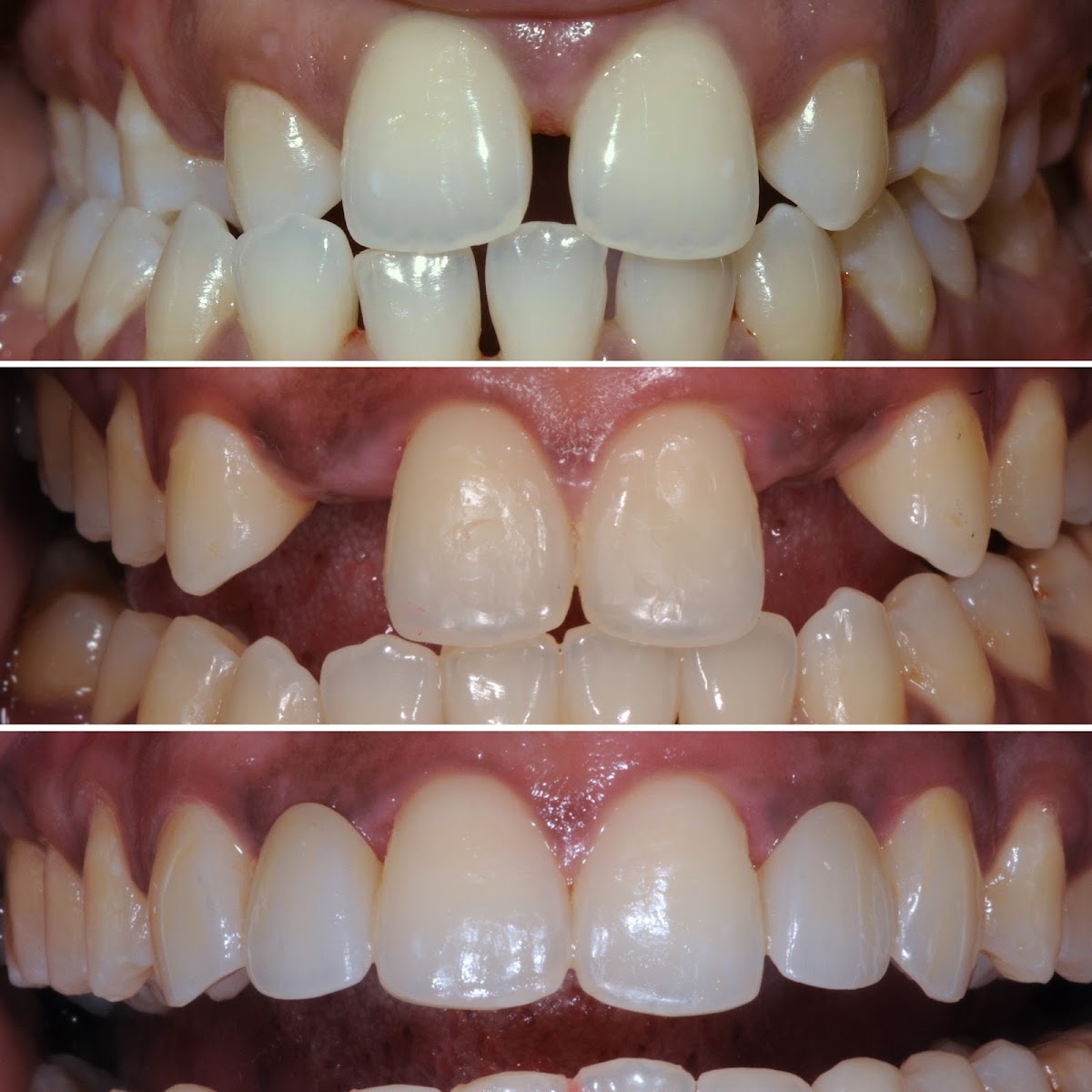 Limelight Dental dental clinic in Mississauga - Photo 4
