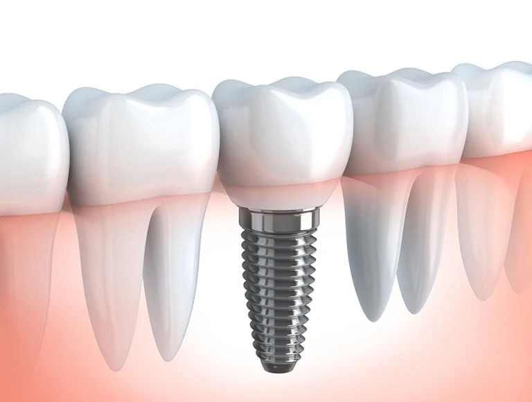 Rockwest Dental Clinic Mississauga dental clinic in Mississauga - Photo 3