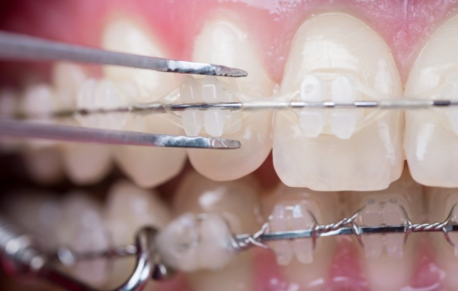 Harborn Dental Centre dental clinic in Mississauga - Photo 6