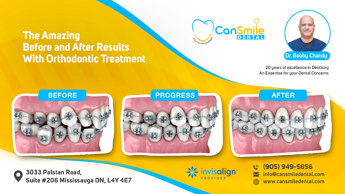 CanSmile Dental - Dentist in Mississauga dental clinic in Mississauga - Photo 5