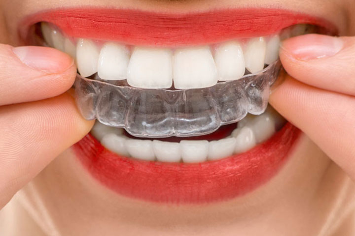 GD Orthodontics dental clinic in Mississauga - Photo 2