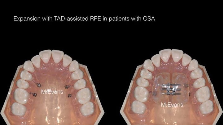 GD Orthodontics dental clinic in Mississauga - Photo 8