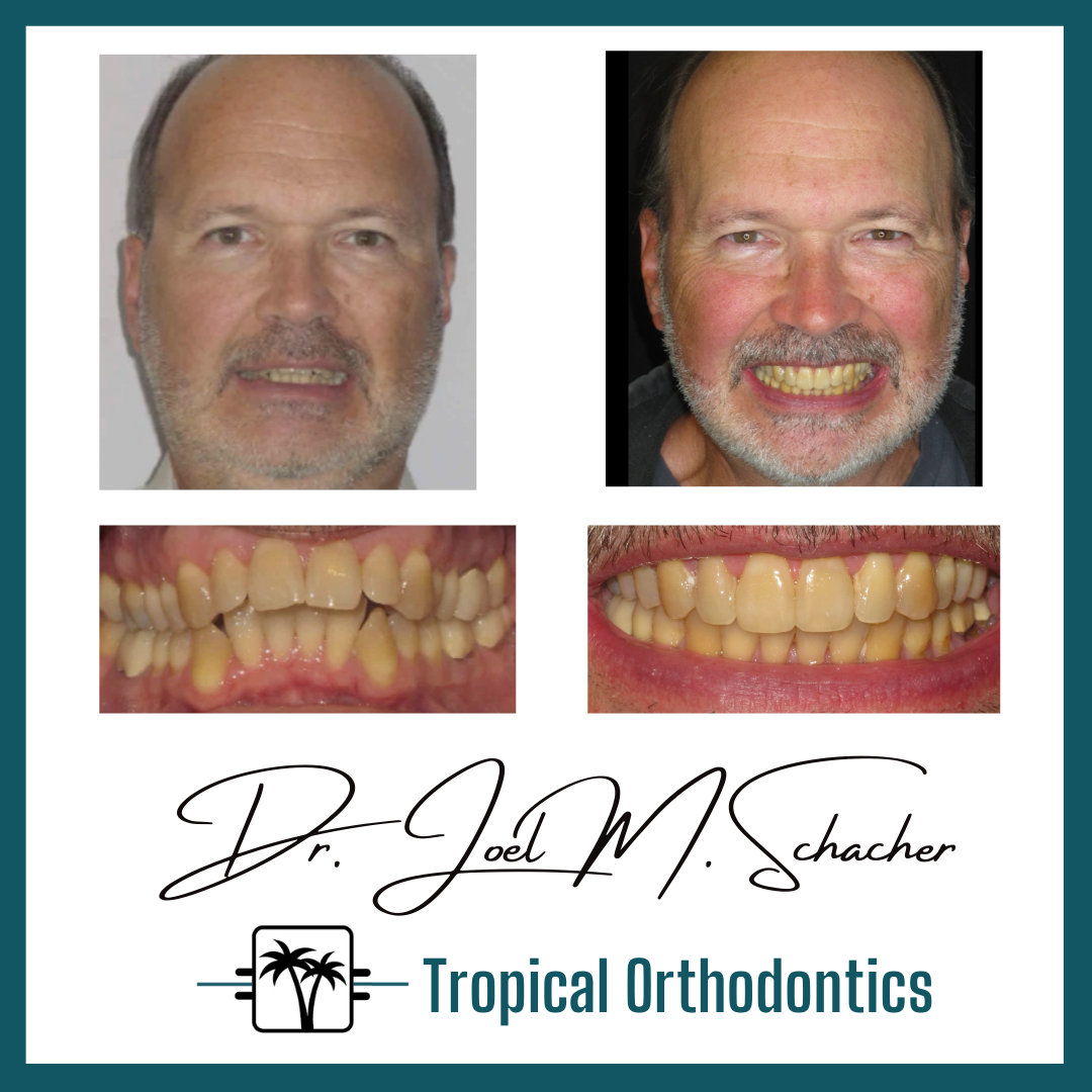 Tropical Orthodontics - Dr. Joel Schacher dental clinic in Mississauga - Photo 3