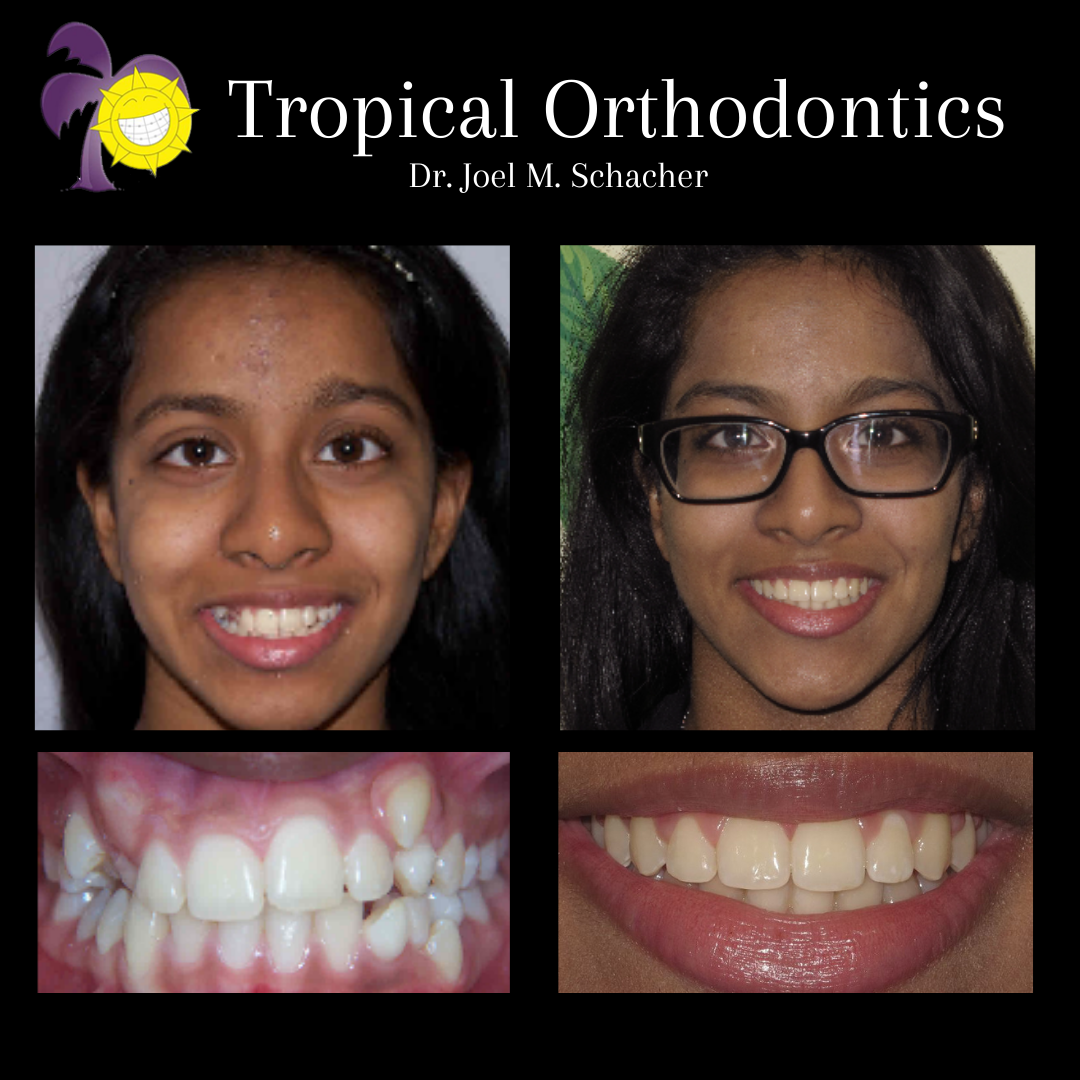 Tropical Orthodontics - Dr. Joel Schacher dental clinic in Mississauga - Photo 4