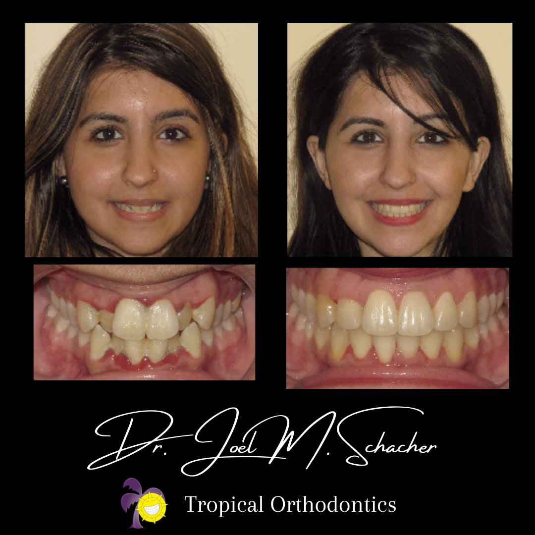 Tropical Orthodontics - Dr. Joel Schacher dental clinic in Mississauga - Photo 5