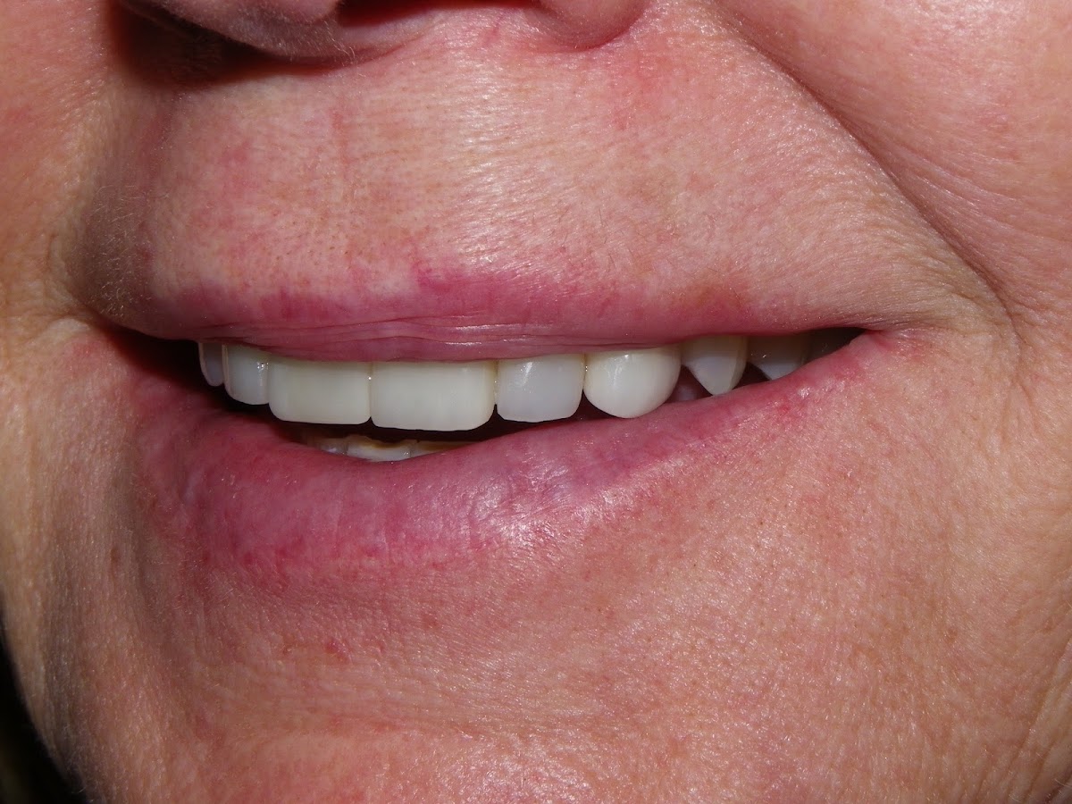 Dr. Elston Wong Dentistry dental clinic in Barrie - Photo 8