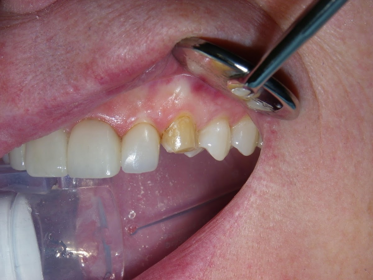 Dr. Elston Wong Dentistry dental clinic in Barrie - Photo 10