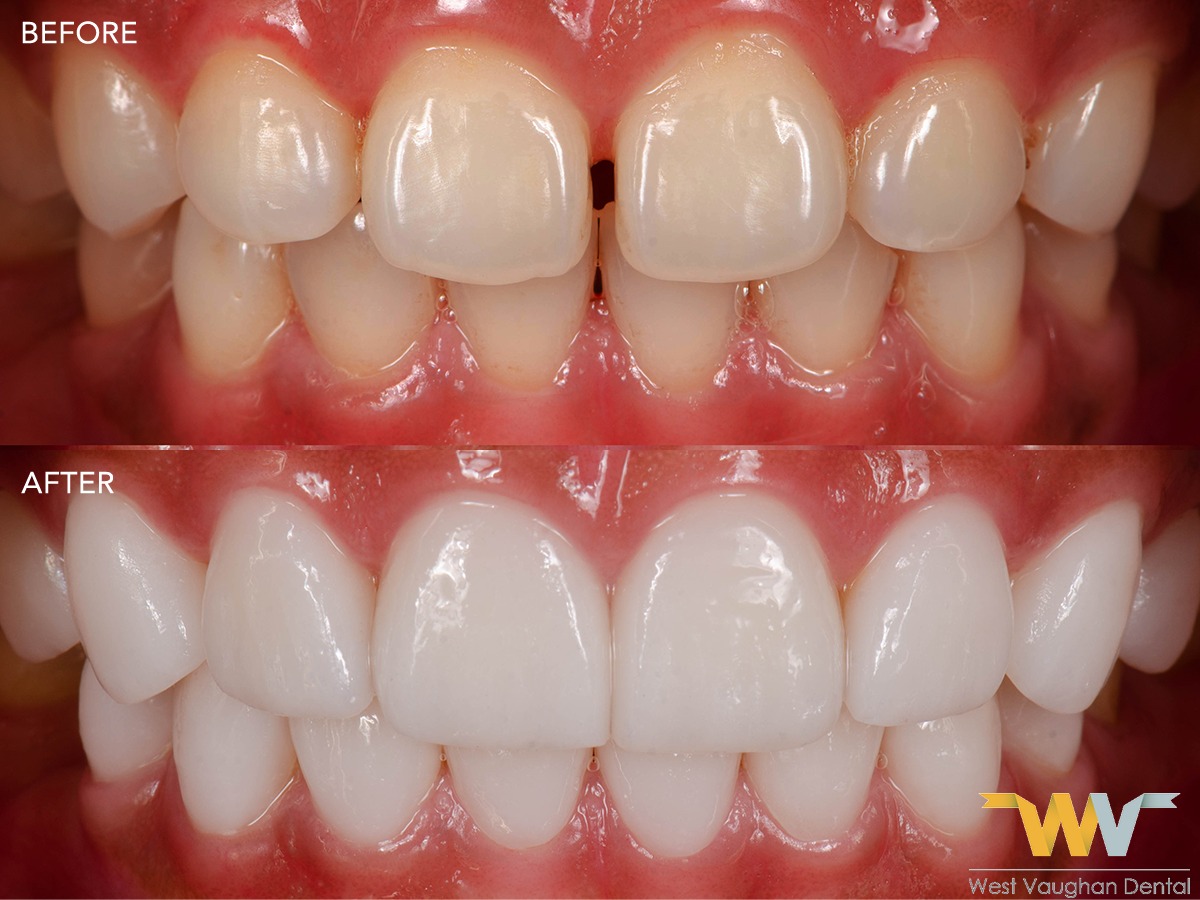 West Vaughan Dental part of Sabharwal Dental Group dental clinic in Vaughan - Photo 1