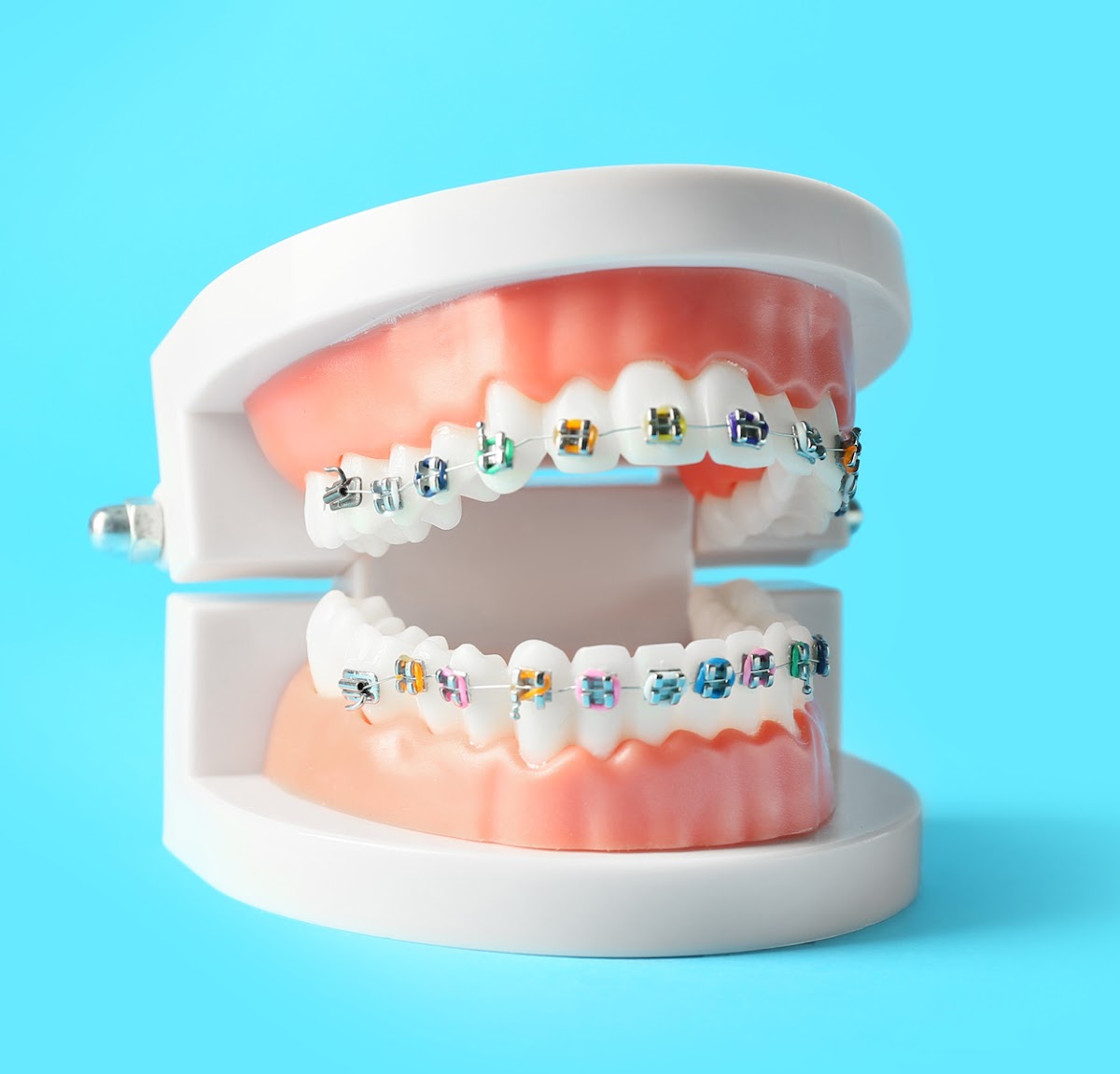 Davis Orthodontics- Woodbridge dental clinic in Vaughan - Photo 1