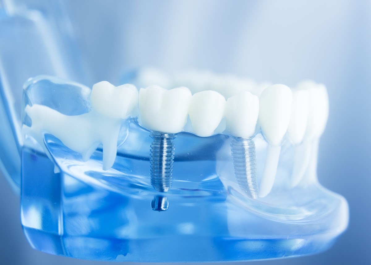 Daljeet & Tabuchi Dentistry dental clinic in Scarborough - Photo 10
