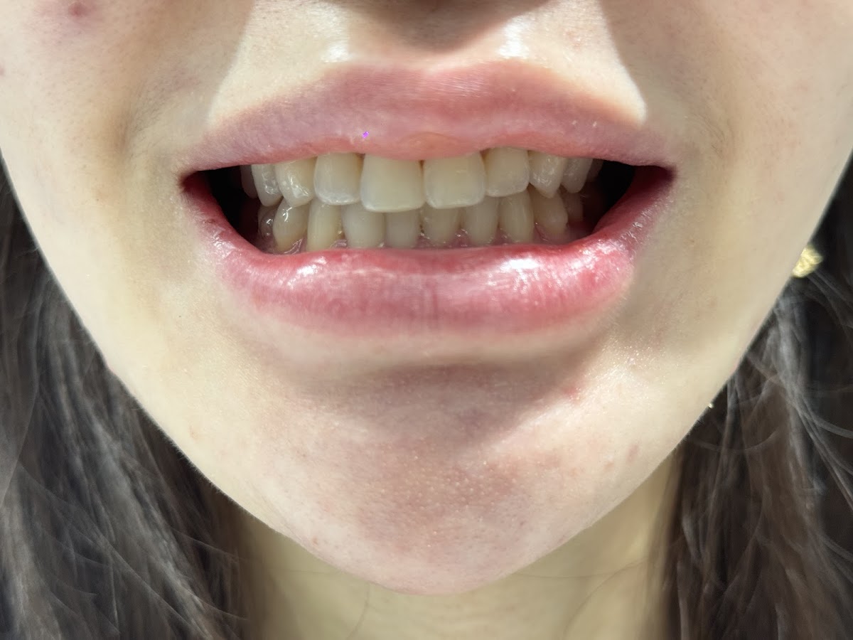 Markham Smile Centre dental clinic in Markham - Photo 9