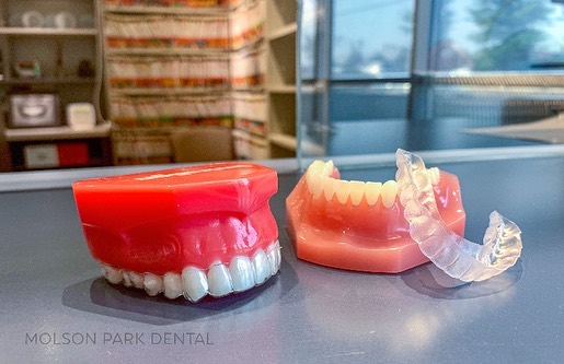 Molson Park Dental dental clinic in Barrie - Photo 7