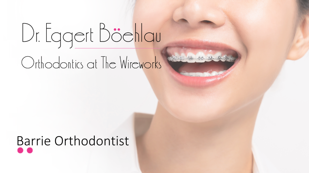 Orthodontics at the Wireworks dental clinic in Barrie - Photo 7