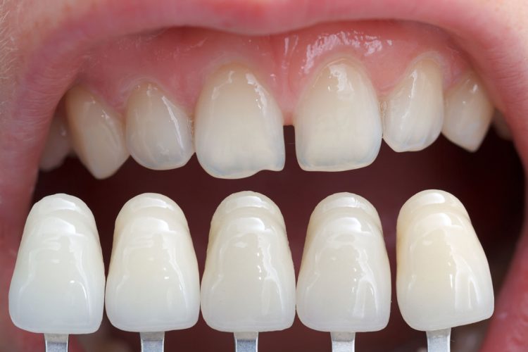 Erin Mills Smiles Dentistry dental clinic in Mississauga - Photo 4