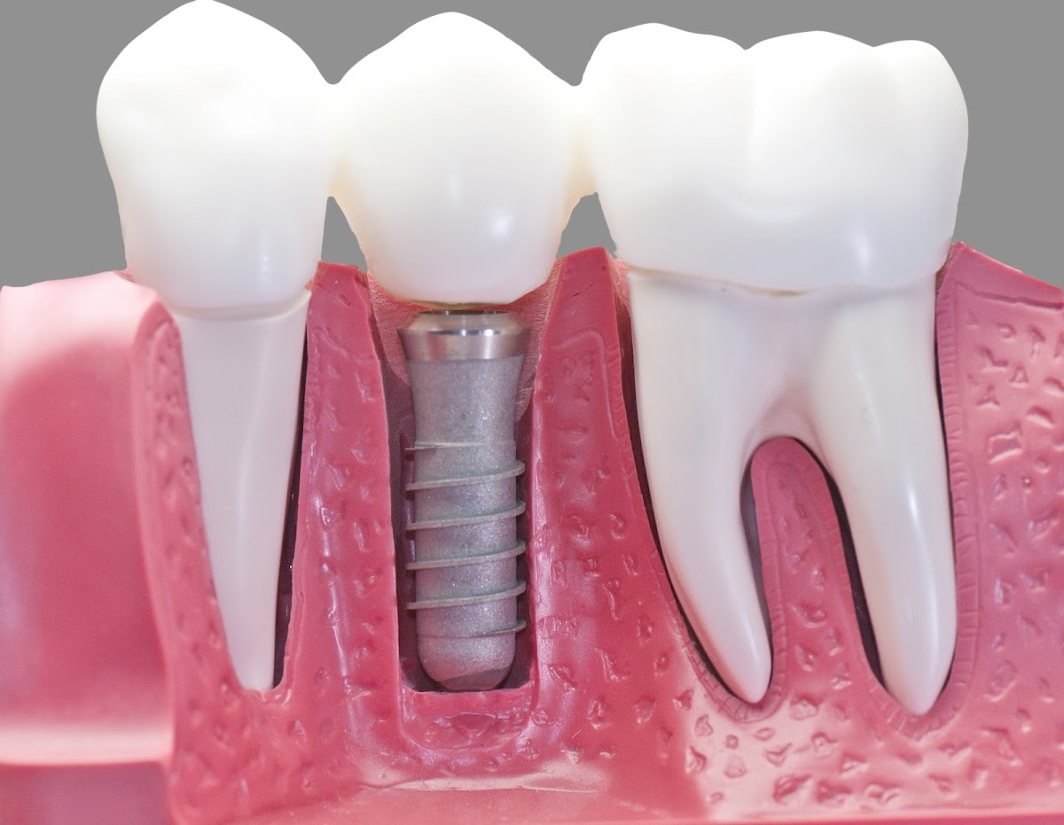 Neate Family Dental dental clinic in Victoria - Photo 3