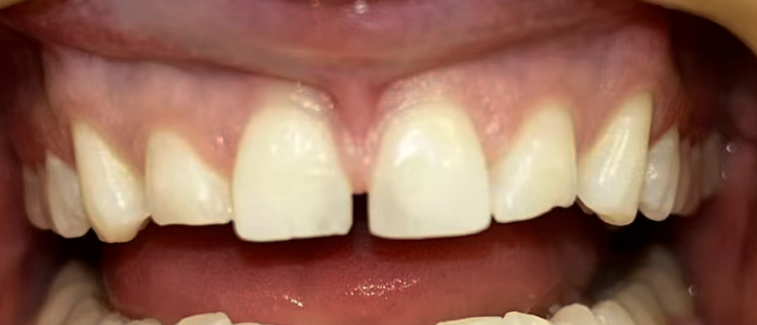 Gallery Centre dental clinic in Whitby - Photo 8