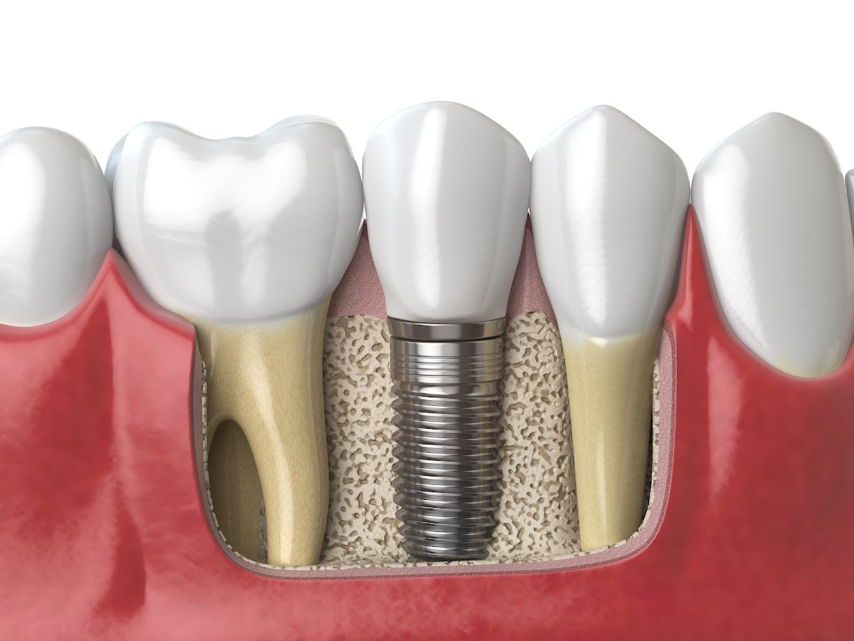 Smilee Dental Centre dental clinic in Thorold - Photo 6
