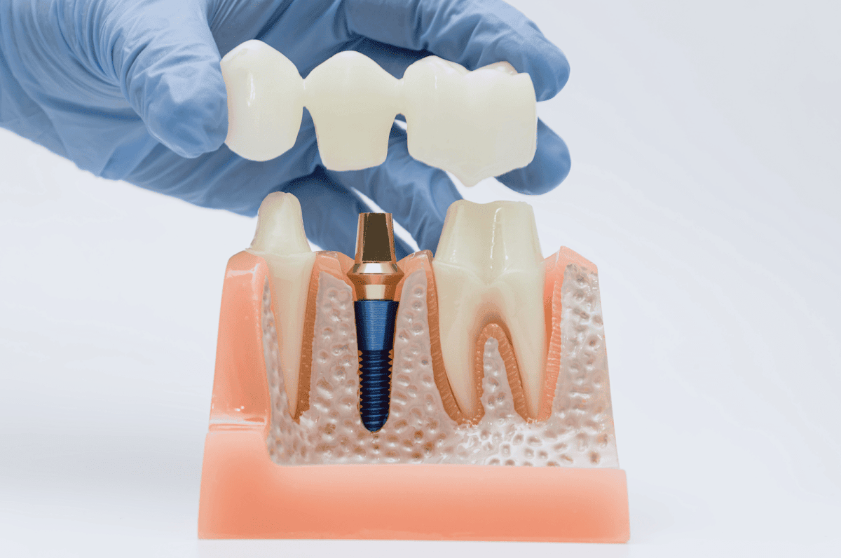 White Rose Dental Studio dental clinic in Burlington - Photo 7