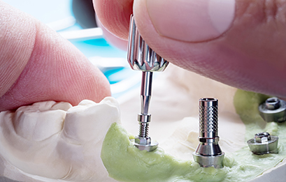 Trillium Smile Dentistry dental clinic in Mississauga - Photo 7