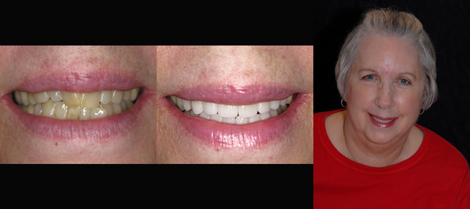Kerrisdale Dental Centre dental clinic in Vancouver - Photo 6