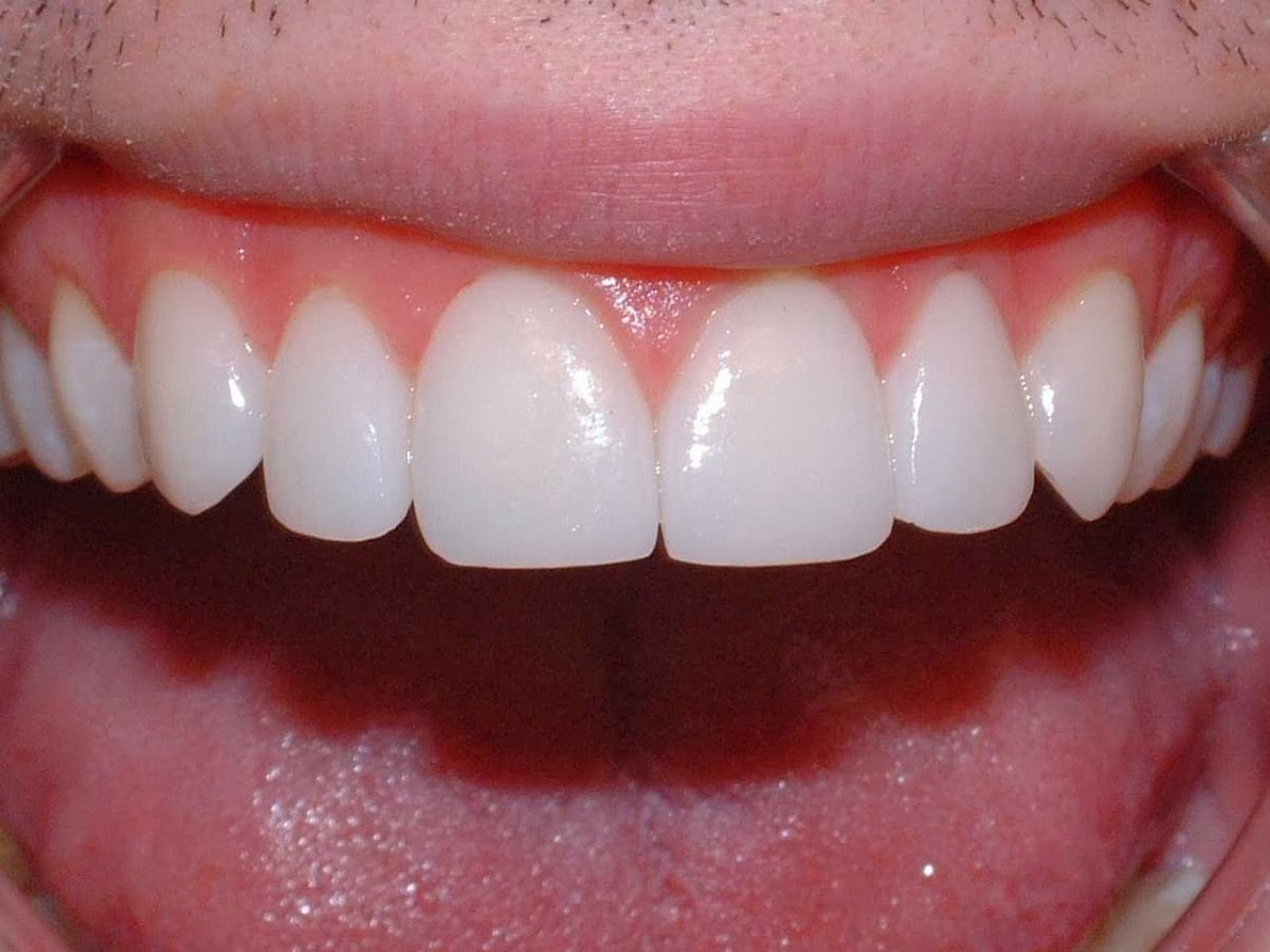 Orchard Heights Dental Centre dental clinic in Aurora - Photo 4