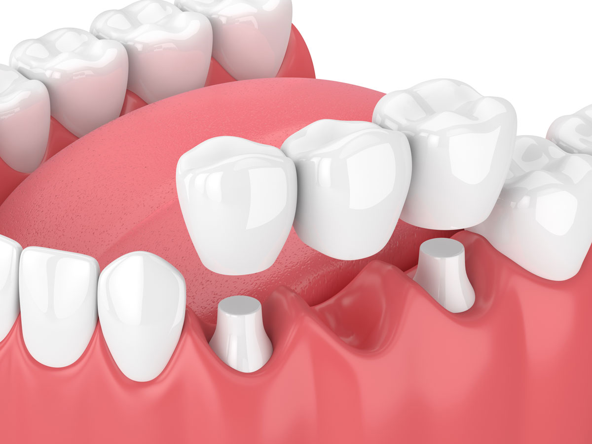 Bakerview Dental Centre dental clinic in Victoria - Photo 9