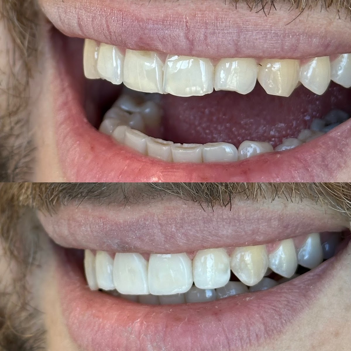 Broadway Dental dental clinic in Vancouver - Photo 6