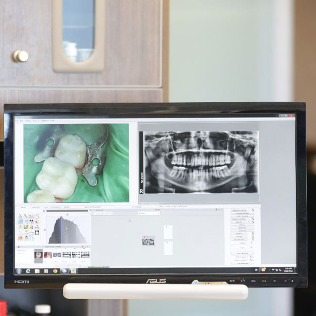 Image Smiles Dental Vancouver dental clinic in Vancouver - Photo 10