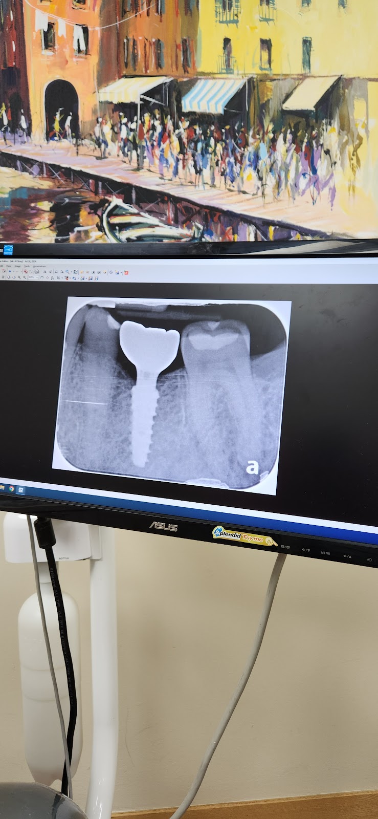Quayside Dental Centre dental clinic in North Vancouver - Photo 8