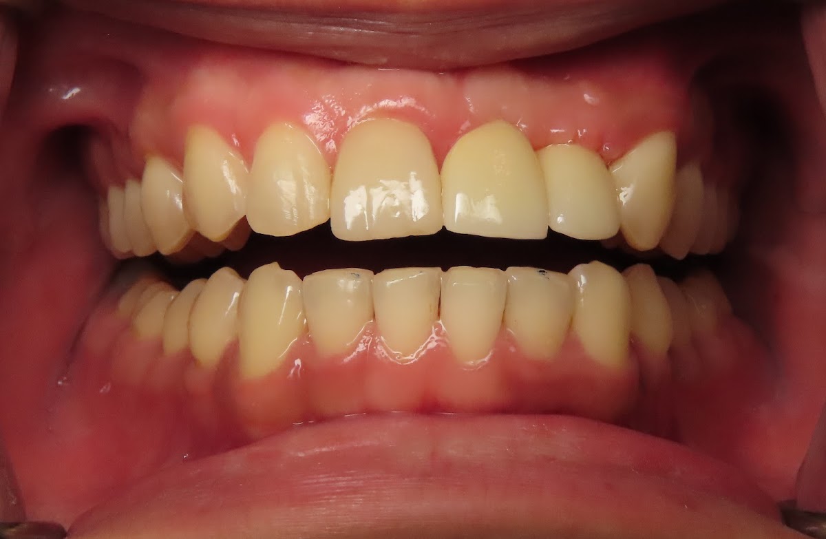 North Vancouver Dentistry & Implant Centre dental clinic in North Vancouver - Photo 4