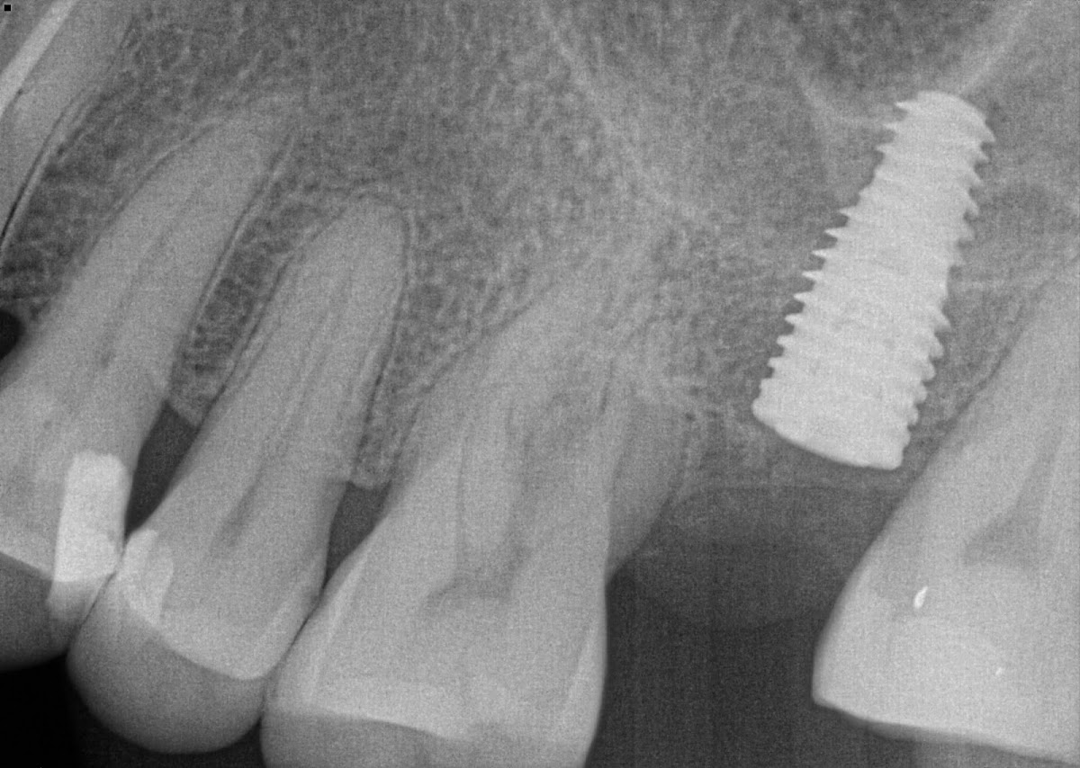 Burnaby Dental & Implant Centre dental clinic in Burnaby - Photo 10