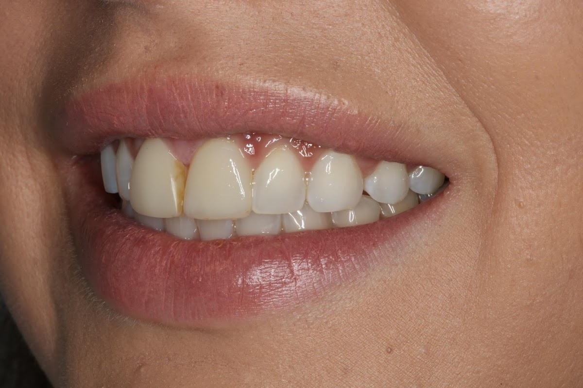 The Lowe Centre dental clinic in Vancouver - Photo 9