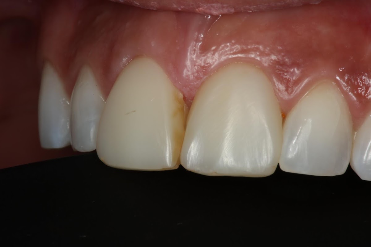 The Lowe Centre dental clinic in Vancouver - Photo 10