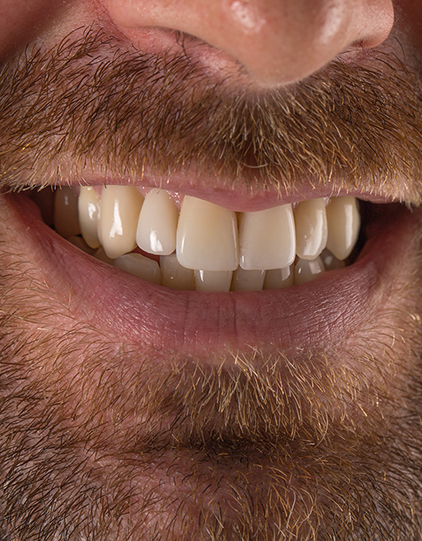 Oceanfront Dental dental clinic in Vancouver - Photo 5