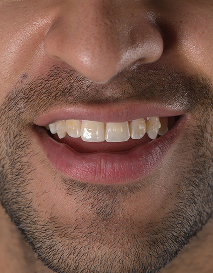 Oceanfront Dental dental clinic in Vancouver - Photo 6