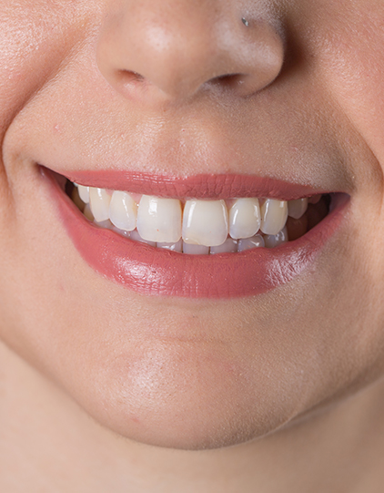 Oceanfront Dental dental clinic in Vancouver - Photo 8