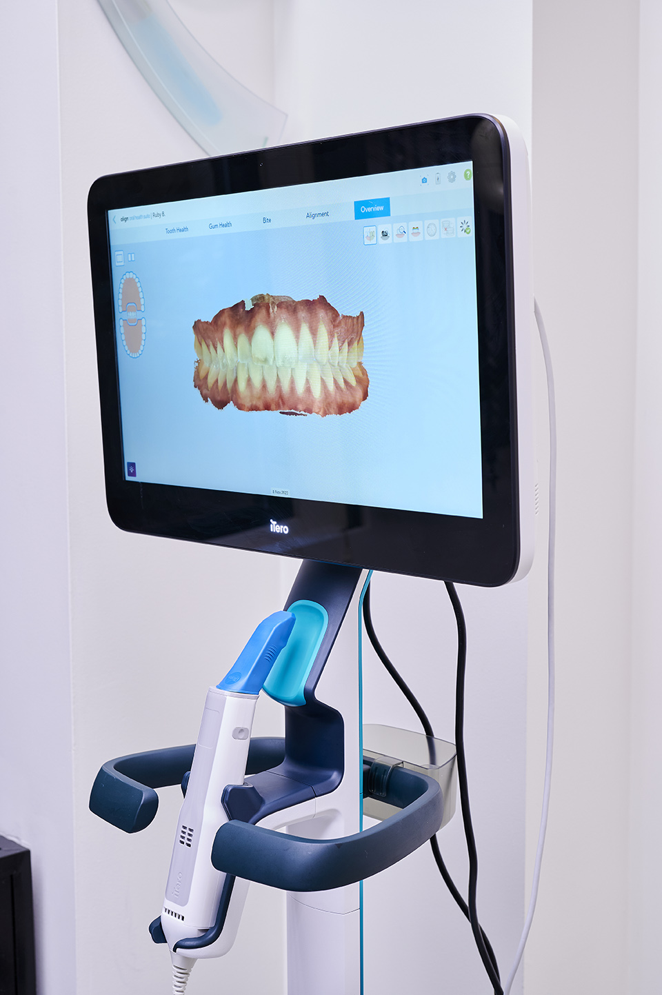 Westcoast Smile Dental dental clinic in Vancouver - Photo 9