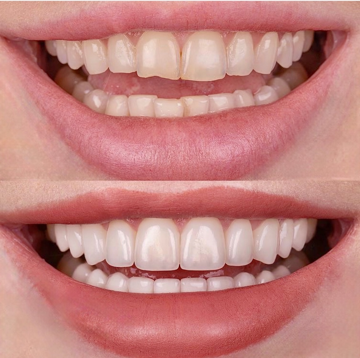 Parkview Dental and Implant Center dental clinic in Vancouver - Photo 3