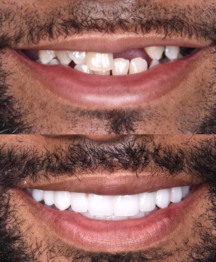 Parkview Dental and Implant Center dental clinic in Vancouver - Photo 5
