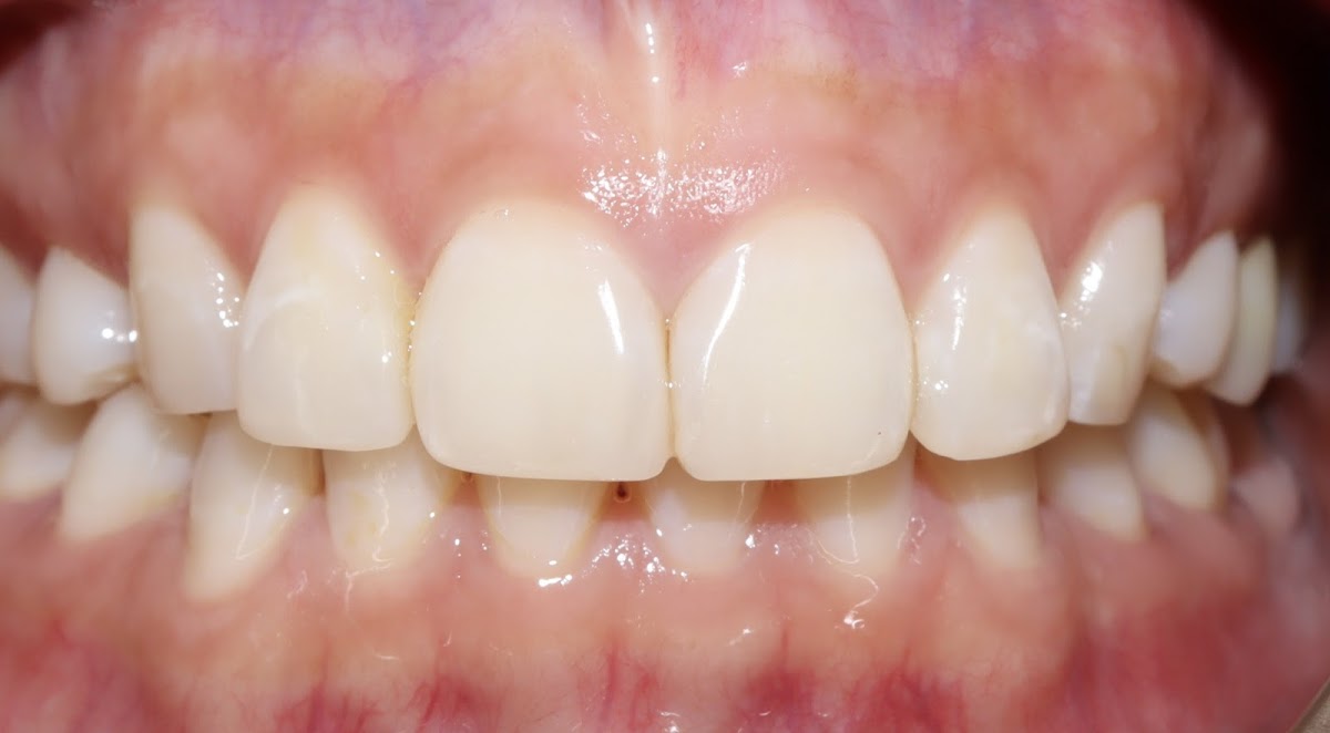Brookmere Dental Group dental clinic in Coquitlam - Photo 2