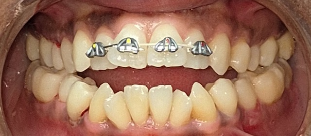 Burnaby Heights Dental Centre dental clinic in Burnaby - Photo 9