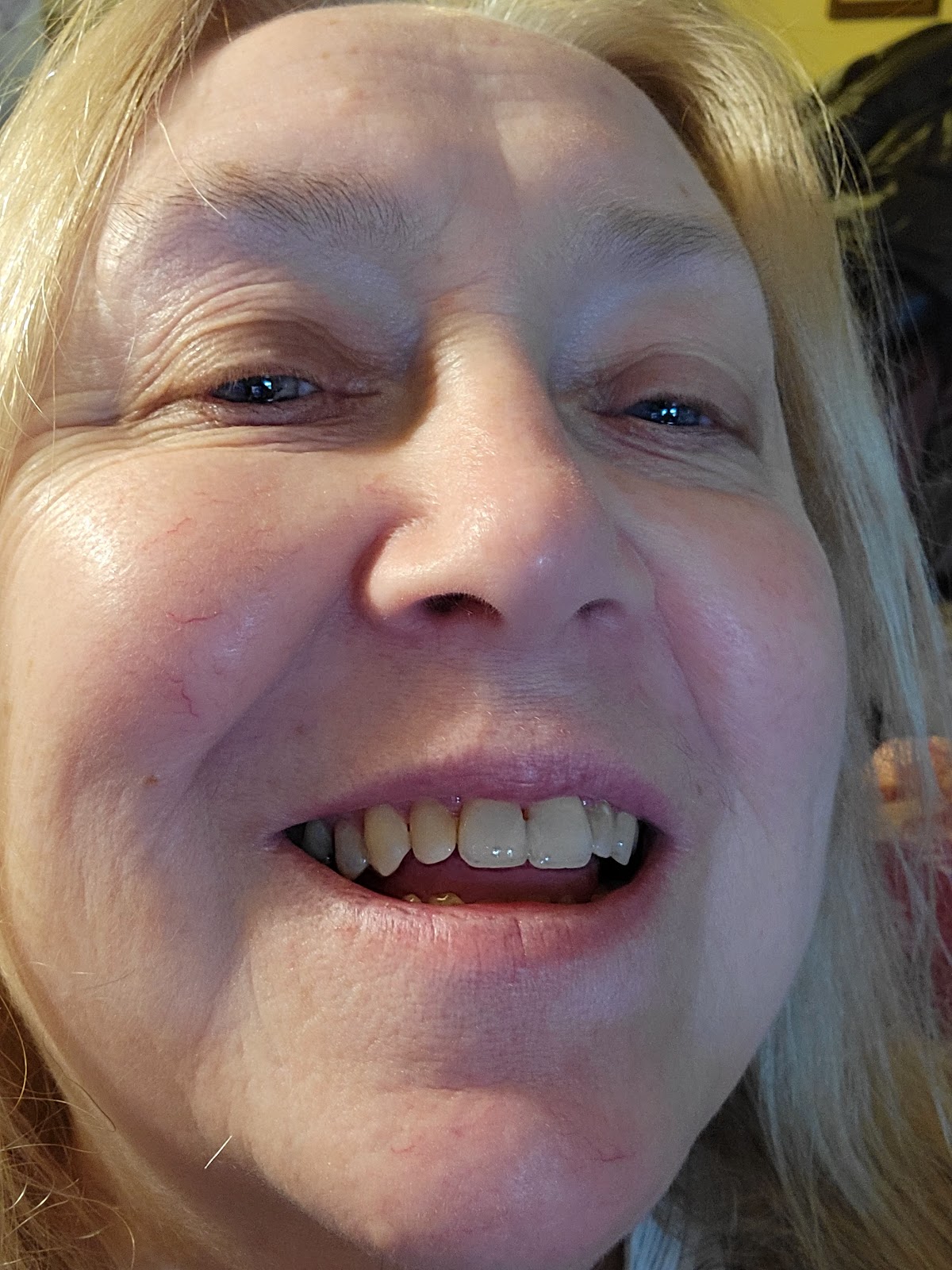 Eagle Creek Dental dental clinic in Burnaby - Photo 10
