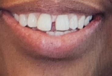 Dentist On Kingsway dental clinic in Vancouver - Photo 6