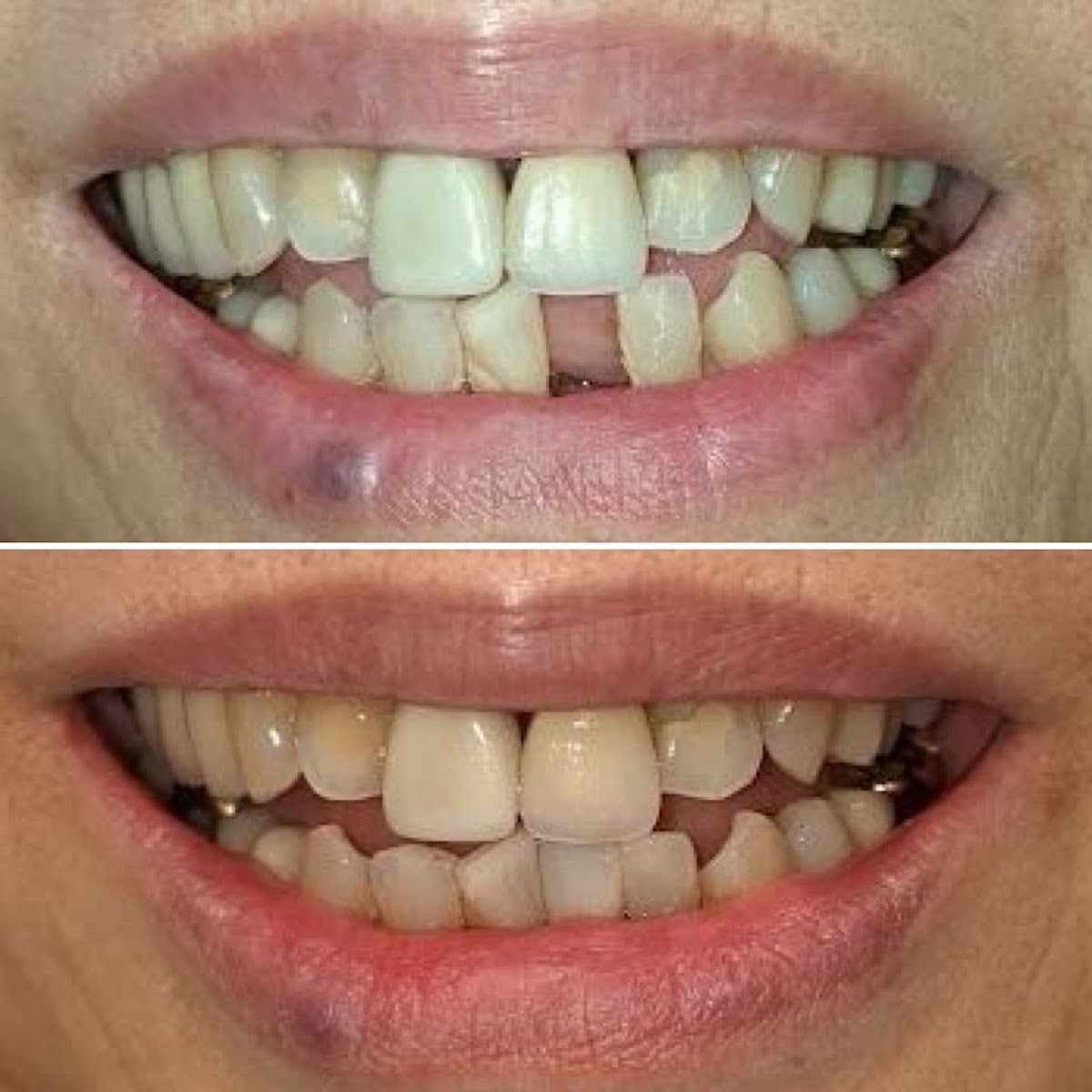 Simply Wellness Dental Burnaby dental clinic in Burnaby - Photo 10