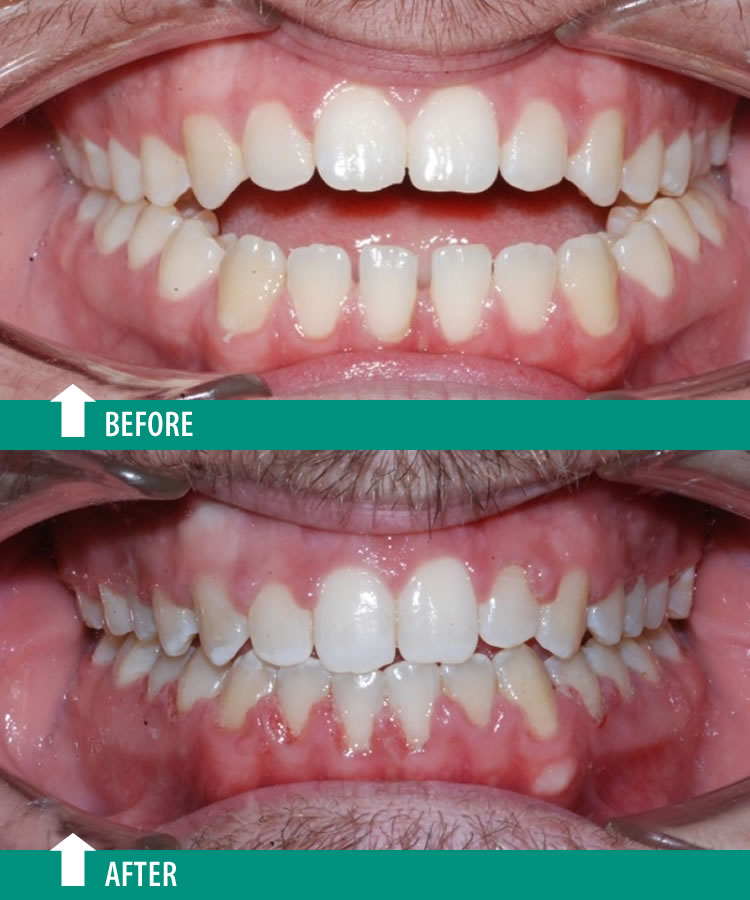 Orthodontist, Dr. Gagan Bhalla dental clinic in Mississauga - Photo 5