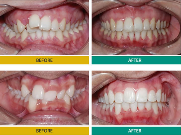 Orthodontist, Dr. Gagan Bhalla dental clinic in Mississauga - Photo 6